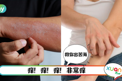 生活 | 肌肤干痒敏感，新年大热天更明显！给你3个止痒Tips，这个更是5分钟内止痒！