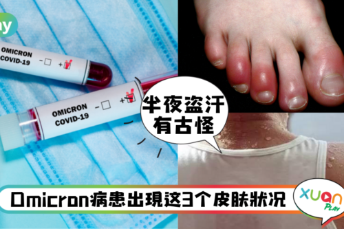 生活｜Omicron太像感冒难分辨，5个特殊病症要注意，半夜盗汗有古怪！