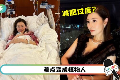 李嘉欣急救48小时保命！原因疯传：减肥过度