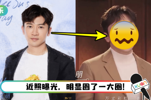 48岁苏有朋崩坏了！ 脸肿一圈变大叔…网惊：这谁