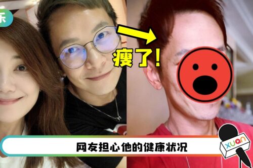 49岁张智成暴瘦!顶大眼袋入镜自嘲:滤镜也救不了