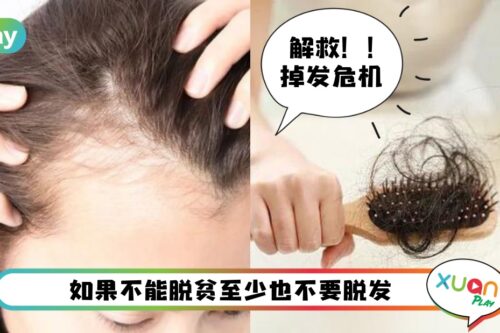 Tips I 头发最爱这些食物,害怕秃头的话就赶紧吃起来!