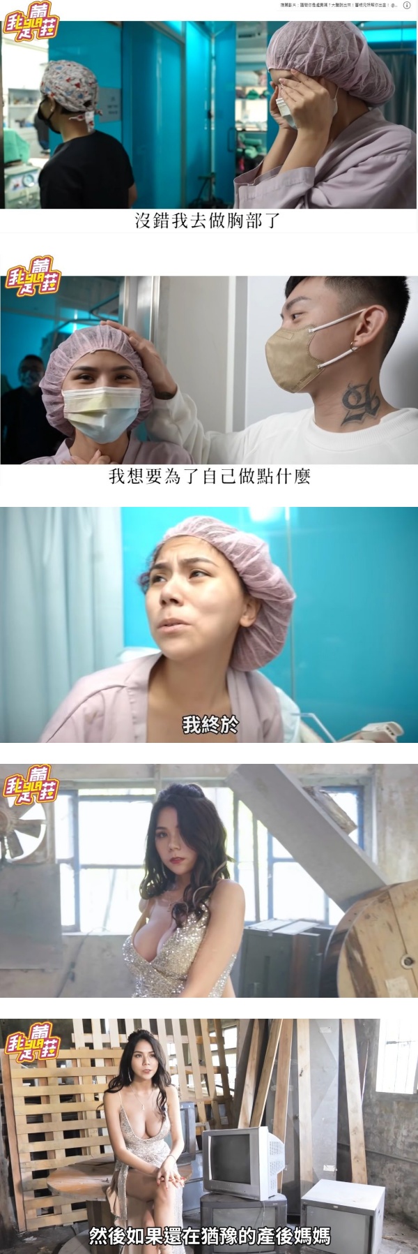 因胸部下垂+萎缩自卑3年…蕾菈大胆宣布隆胸成功！术后一度尿失禁 娱乐资讯 图2张