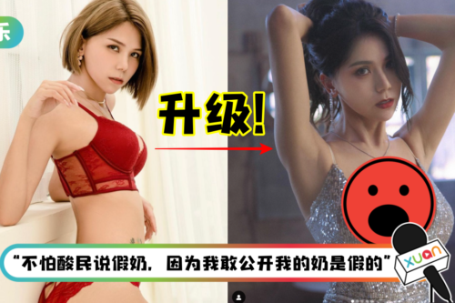 因胸部下垂+萎缩自卑3年…蕾菈大胆宣布隆胸成功！术后一度尿失禁