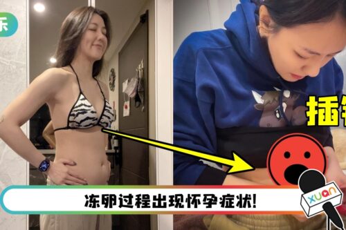 “马来西亚榴梿公主”进行冻卵手术!肚皮插针画面曝光“没有想象中可怕”