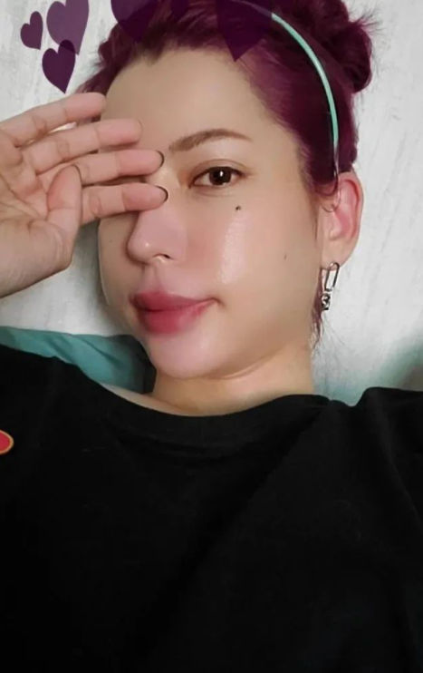 Keanna颜面神经失调...左脸肿一大块！像用了“胖子滤镜” 娱乐资讯 图1张