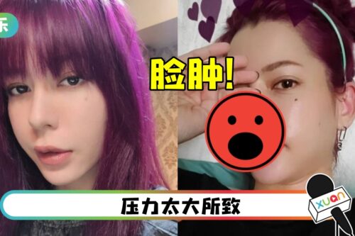 Keanna颜面神经失调…左脸肿一大块!像用了“胖子滤镜”