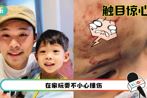 陈威全4岁儿子不慎撞破头！“头破血流照”太可怕遭屏蔽