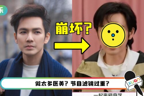 48岁钟汉良脸僵硬崩坏、两侧苹果肌肿胀!网:整容了?