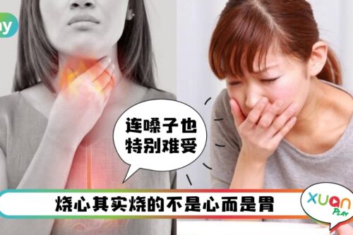 Tips I 饭后胸口火辣辣反胃难受？6种食物有效缓解“烧心”