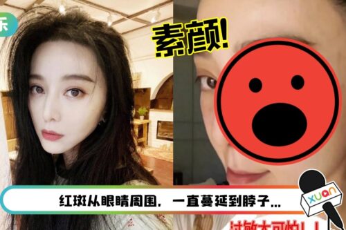 赴韩拍戏不适应？范冰冰首次出现“皮肤严重过敏”：好可怕