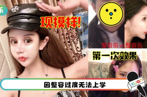 18岁网红3年整容60次！“身材和脸蛋才是自己最好的奢侈品”