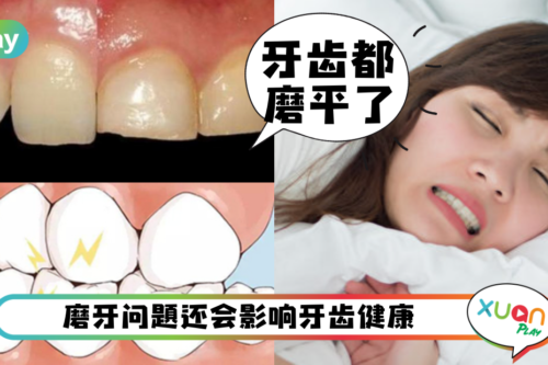 生活｜睡觉磨牙是因为肚子有虫？告诉你5个磨牙背后的真相