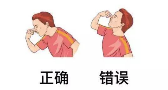 Tips｜突然流鼻血吓坏人，头往后仰、纸塞鼻子都是错错错！ 更多热点 图3张