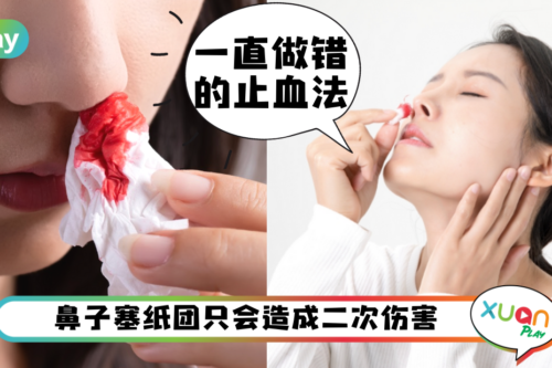 Tips｜突然流鼻血吓坏人，头往后仰、纸塞鼻子都是错错错！