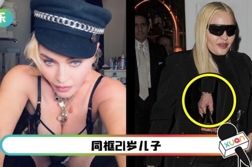 63岁Madonna被拍到“爆青筋、皮肤松垮”近照！与冻龄美貌极不符