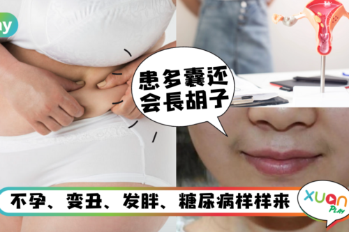 健康｜多囊卵巢症拖着不治可以吗？除了不孕小心还会酿成“大祸”！