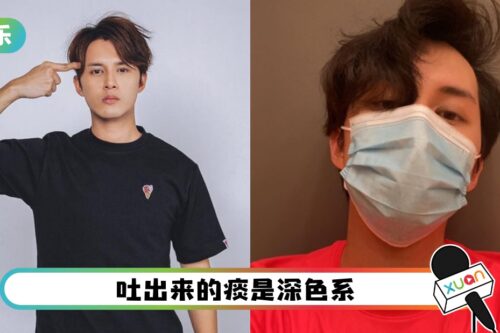 何广沛确诊!有齐Omicron病症:发烧、喉咙痛、咳嗽