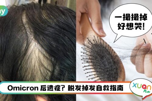 Tips I 确诊痊愈后掉发后遗症?6个洗护技巧助脱发党逆袭