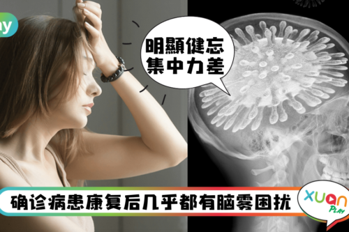 Tips｜染Omicron出现脑雾后遗症，教你4个日常调理解除症状！