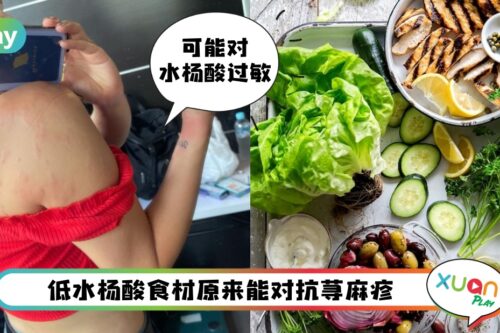 Tips I 荨麻疹过敏找不到原因？难道是水杨酸食物导致