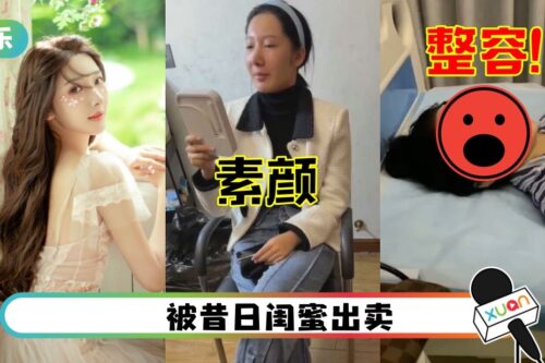 素颜照疯传全网…都美竹再被曝光整容照!花5位数动鼻子、下巴