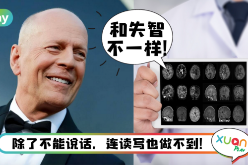 健康｜得了失语症就是不能说话？30秒速速了解巨星Bruce Willis患上的失语症！