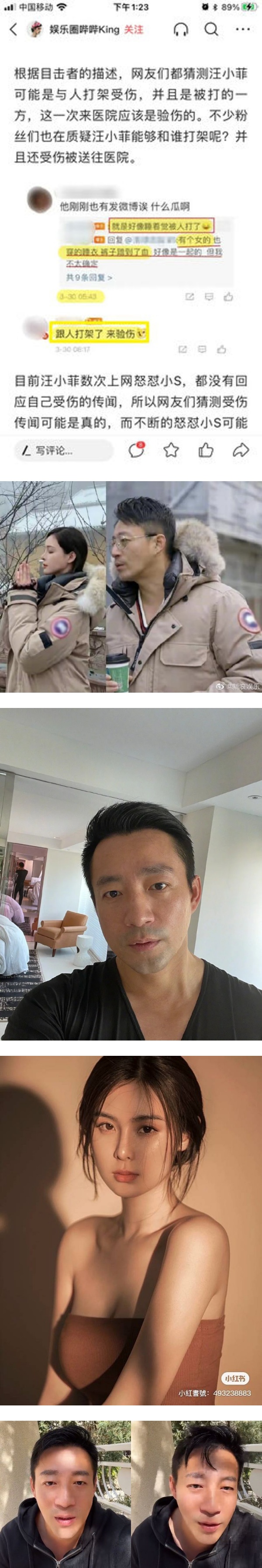 汪小菲被玻璃瓶爆头入院！不爽具俊晔入住S家 派人深夜上门搬家私 娱乐资讯 图1张