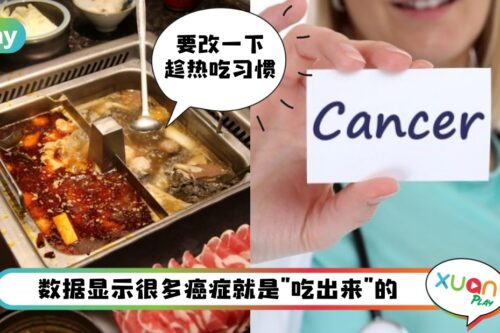 Tips I 癌从口入！这6种癌症都跟不良饮食习惯有关