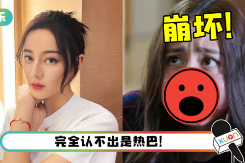 绝世美颜崩坏了！ 迪丽热巴肿成猪头+香肠嘴…网全看傻