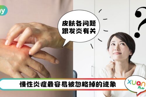 Tips I 10个轻度慢性炎症迹象，大部分人都中一两个！