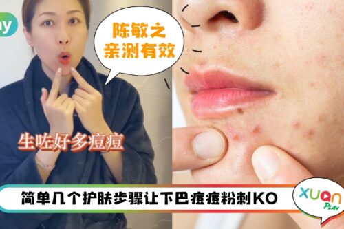 Tips I 戴口罩时间长下巴狂爆痘!陈敏之一招护肤KO痘痘