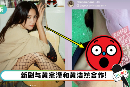 周秀娜拍新剧心口长满“痘痘”！ 高呼：救命好痒！