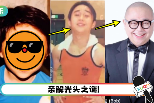 Bob林盛斌自曝请专人打理头发!光头竟是自己造成的