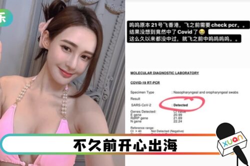 Yumi黄诗棋确诊！狂咳嗽2天…飞行前做PCR才发现