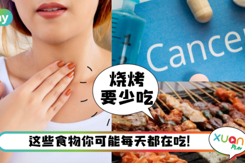 健康｜癌症最喜欢的5样东西，想健康就别再“喂养”癌细胞！