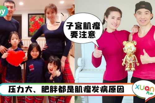 健康｜刘畊宏太太王婉霏因子宫肌瘤摘子宫，这4个发病原因绝对要注意！