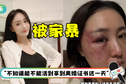 网红结婚半年被家暴4次！ 老公企图用枕头闷死她