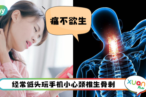 健康 I 不想患上颈椎候群症!这两个生活习惯一定要改!