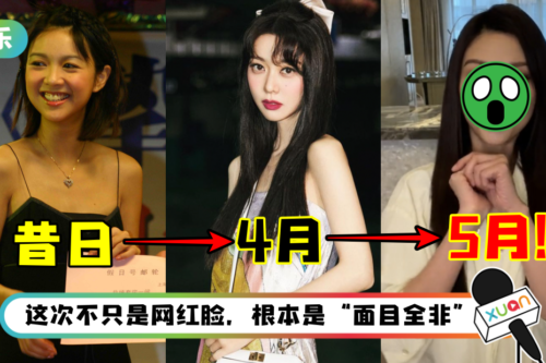 薛凯琪又双叒叕变样了！网狠批：这次连亲妈都认不得