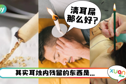 健康｜能吸出耳屎那么厉害？关于香薰耳烛疗法的5件事！