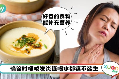 Tips I 喉咙痛到喝水都痛苦！选择这些5种食物更好吞
