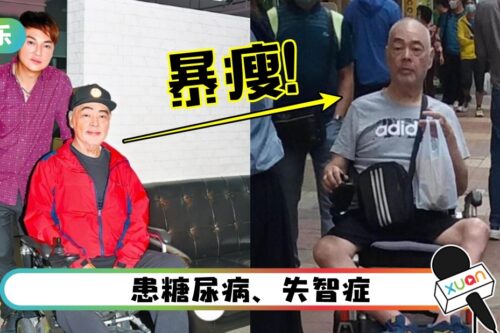 68岁张伟文曝养老院内自残、向隔壁床扔杂物！暴瘦至双腿见骨