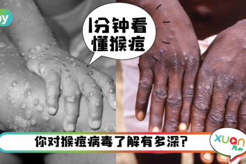健康｜猴痘病毒持续在多国蔓延，关于猴痘你想懂的5件事！