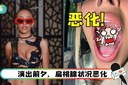 26岁歌手被迫开刀！服用抗生素治疗中“天天放纵喝酒、抽电子烟”