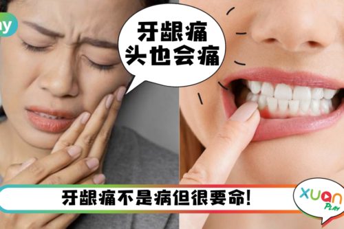 Tips｜牙龈肿痛喊救命！试用着5个小偏方缓缓痛！