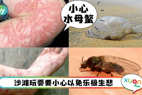 Tips｜海边游玩3个注意！小心水母螫伤、玩埋沙小心感染寄生虫