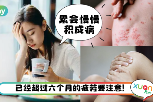 健康｜疲劳还有分慢性？这9种症状要是超过4种要注意！