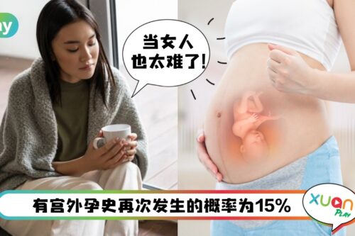 健康 I 宫外孕反复发生？这5种问题都会引起宫外孕