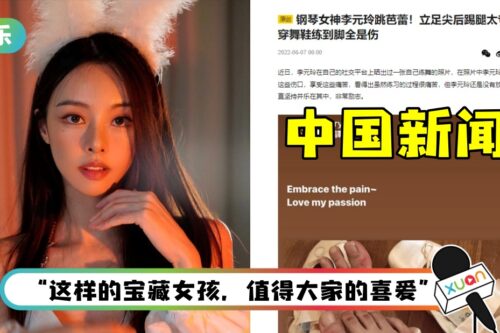 李元玲“双腿布满伤痕照”登内地新闻！赞她：非常励志